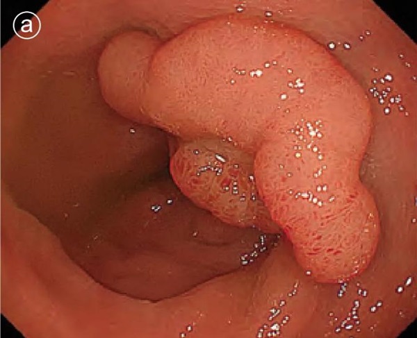 1737105989702027.jpg 圖片2.jpg