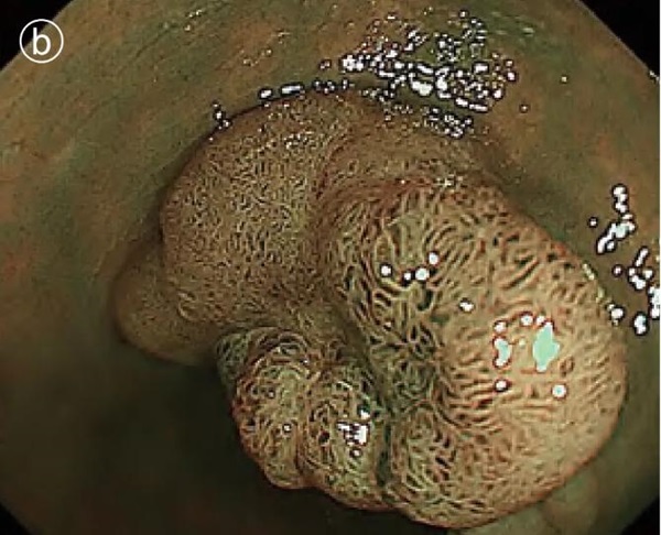 1737105996405318.jpg 圖片3.jpg