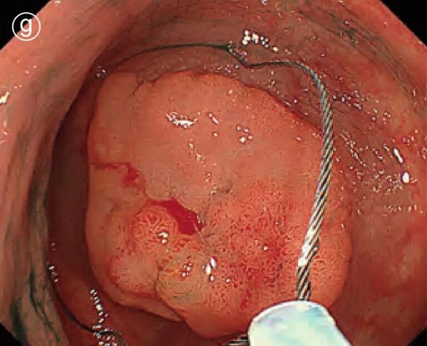 1737106039757417.jpg 圖片8.jpg