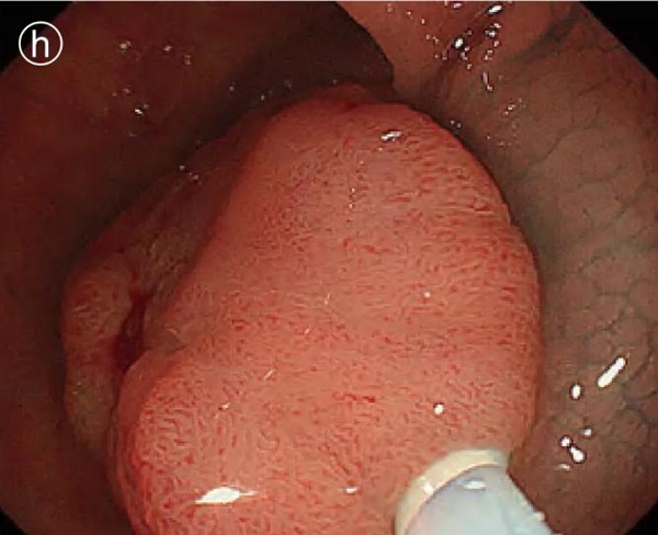 1737106047187676.jpg 圖片9.jpg