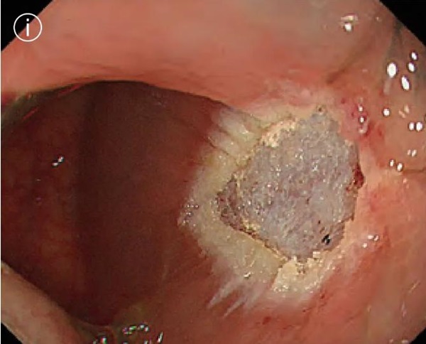 1737106063573325.jpg 圖片10.jpg