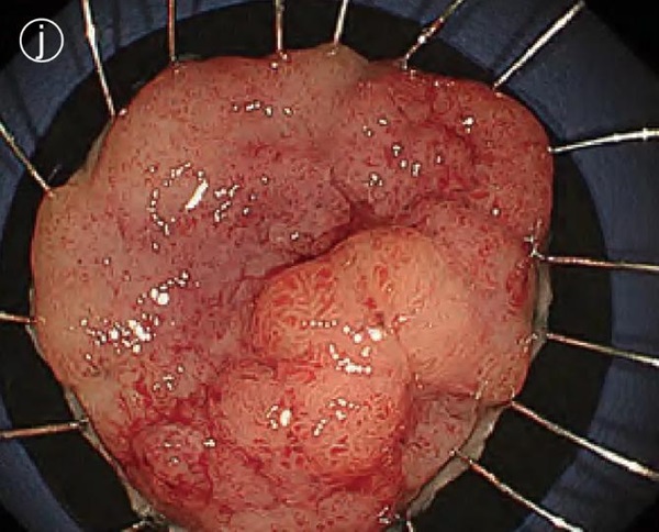 1737106070173475.jpg 圖片11.jpg